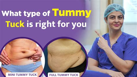The procedure typically takes less than 90 minutes under general anesthesia. . Abex procedure vs tummy tuck
